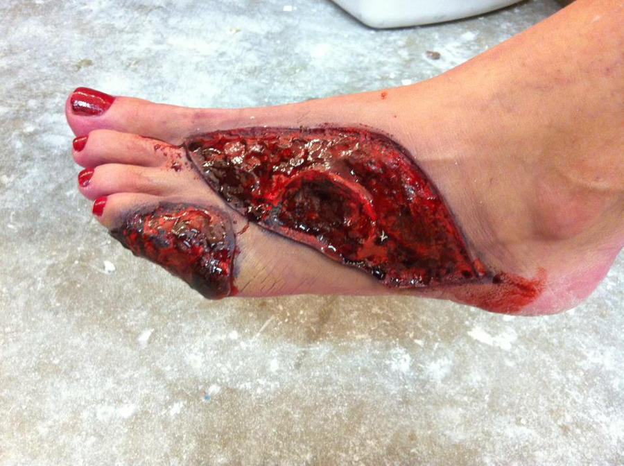 http://fc04.deviantart.net/fs70/i/2012/010/b/7/prosthetic_wounds___foot_injury_by_bronze_for_bets-d4lwb4i.jpg