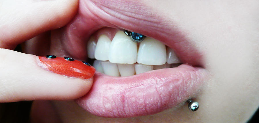 small smiley piercing. what is smiley piercing.