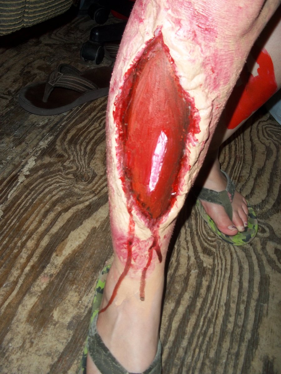 leg wound